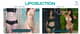 Slider image (4) Calming Confidence in Plastic Surgery at Rattinan Thailand